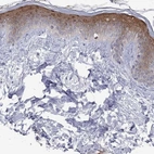 Immunohistochemical staining of human skin shows high expression.