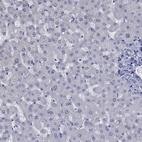 Anti-CTNNBIP1 Antibody