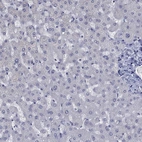 Immunohistochemical staining of human liver shows low expression as expected.