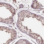Immunohistochemical staining of human testis shows moderate cytoplasmic positivity in cells in seminiferous ducts.