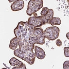 Immunohistochemical staining of human placenta shows moderate cytoplasmic positivity in trophoblastic cells.