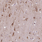 Immunohistochemical staining of human cerebral cortex shows moderate cytoplasmic positivity in neurons.