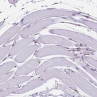 Immunohistochemical staining of human skeletal muscle shows no positivity in myocytes as expected.