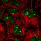 Immunofluorescent staining of human cell line CACO-2 shows localization to nucleus & nucleoli fibrillar center.