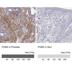 Anti-PGM5 Antibody