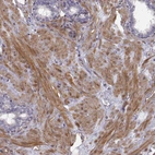 Immunohistochemical staining of human prostate shows moderate cytoplasmic positivity in smooth muscle cells.