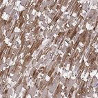 Immunohistochemical staining of human heart muscle shows strong cytoplasmic positivity in cardiomyocytes.