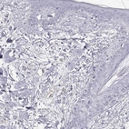 Immunohistochemical staining of human skin shows negative positivity in squamous epithelial cells as expected.