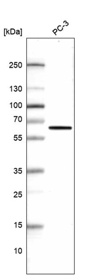 Western blot analysis in human cell line PC-3.