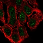Immunofluorescent staining of human cell line RT4 shows localization to nuclear bodies.