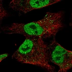 Immunofluorescent staining of human cell line A549 shows localization to nucleoplasm & vesicles.
