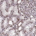 Anti-THAP3 Antibody