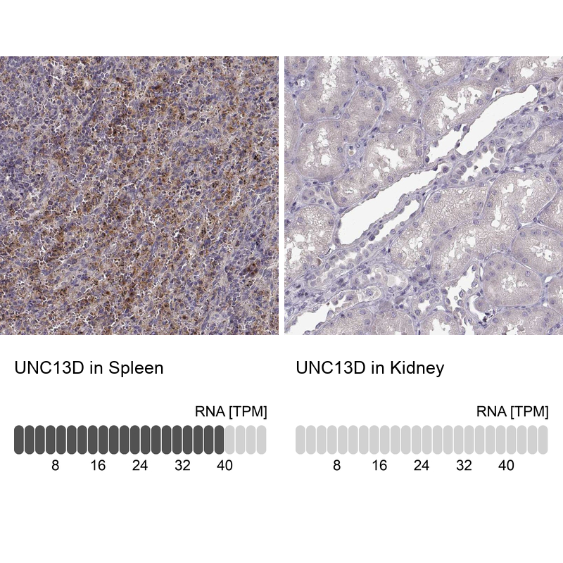 Anti-UNC13D Antibody