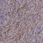 Immunohistochemical staining of human spleen shows high expression.