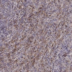 Immunohistochemical staining of human spleen shows high expression.