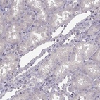 Immunohistochemical staining of human kidney shows low expression as expected.