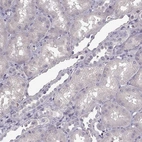 Immunohistochemical staining of human kidney shows low expression as expected.