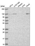 Western blot analysis in human cell line RT-4, human cell line U-251 MG, human plasma, human liver tissue and human tonsil tissue.