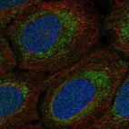 Anti-MRPS15 Antibody