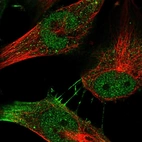 Immunofluorescent staining of human cell line U-251 MG shows localization to nucleoplasm & plasma membrane.