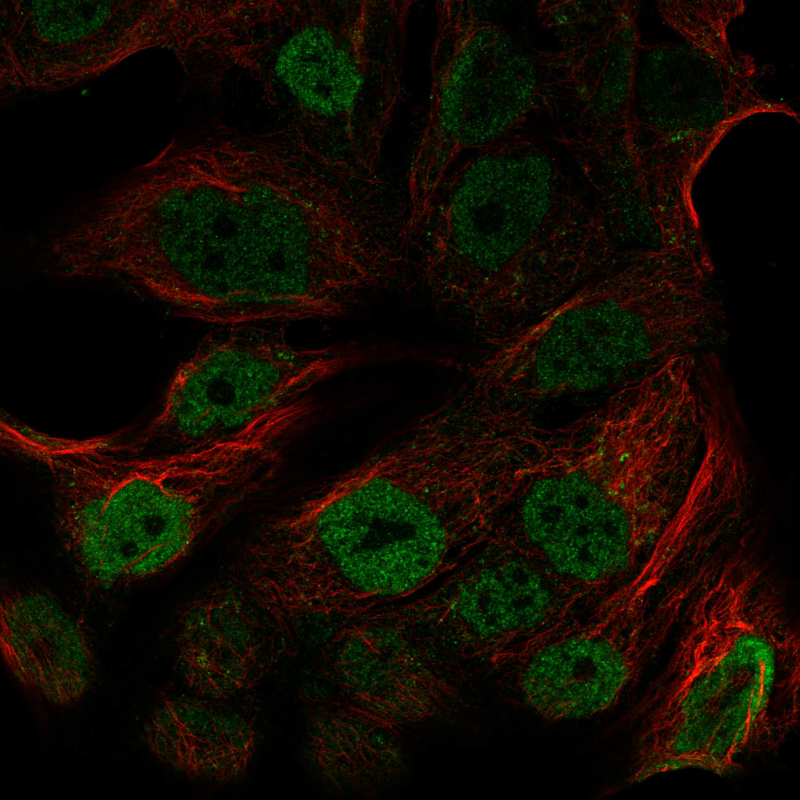 Anti-ATM Antibody