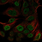 Anti-ATM Antibody