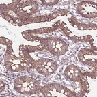Anti-FAM46A Antibody