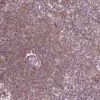 Anti-ADAM33 Antibody