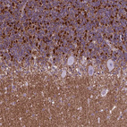 Anti-POU3F3 Antibody