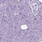 Immunohistochemical staining of human pancreas shows no positivity in exocrine glandular cells as expected.