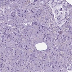 Immunohistochemical staining of human pancreas shows no positivity in exocrine glandular cells as expected.