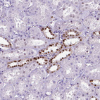 Immunohistochemical staining of human kidney shows moderate to strong nuclear positivity in cells in distal tubules.