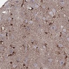 Anti-SNTA1 Antibody