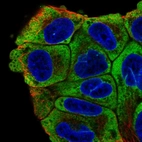 Immunofluorescent staining of human cell line RT4 shows localization to cytosol.
