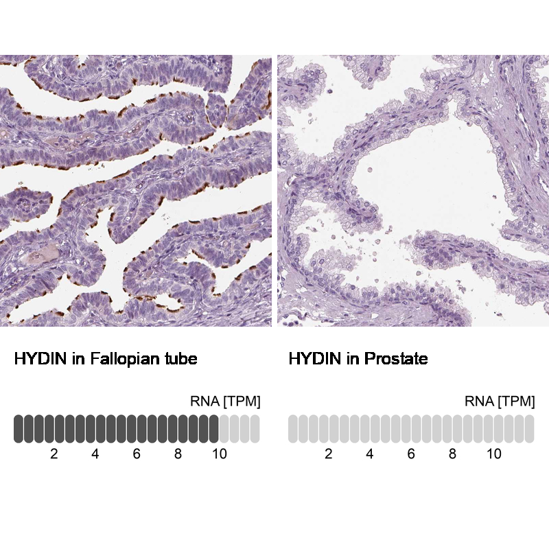 Anti-HYDIN Antibody