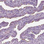 Immunohistochemical staining of human fallopian tube shows strong positivity in cilia in glandular cells.