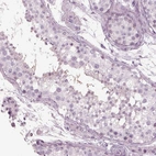 Immunohistochemical staining of human testis shows moderate cytoplasmic positivity in late spermatids.