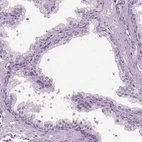 Immunohistochemical staining of human prostate shows no positivity in glandular cells as expected.