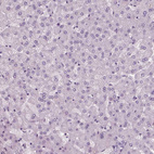 Anti-HYDIN Antibody