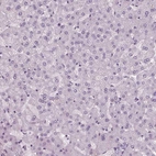 Immunohistochemical staining of human liver shows no positivity in hepatocytes as expected.