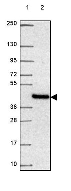 Anti-NIPA2 Antibody