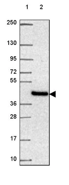Lane 1: Marker [kDa] 250, 130, 95, 72, 55, 36, 28, 17, 10_br/_Lane 2: Human cell line RT-4