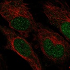 Anti-ZNF594 Antibody