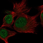 Immunofluorescent staining of human cell line SK-MEL-30 shows localization to nucleus.