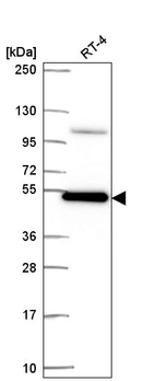 Western blot analysis in human cell line RT-4.