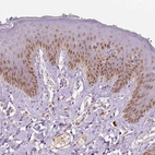 Immunohistochemical staining of human skin shows moderate nuclear positivity in squamous epithelial cells.