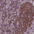 Anti-ACAD10 Antibody