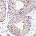Immunohistochemical staining of human testis shows moderate nuclear positivity in cells in seminiferous ducts.