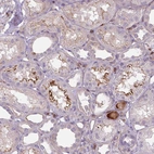 Immunohistochemical staining of human kidney shows moderate positivity in cytoplasm granular in cells in tubules.