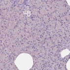 Immunohistochemical staining of human pancreas shows no positivity in exocrine glandular cells as expected.